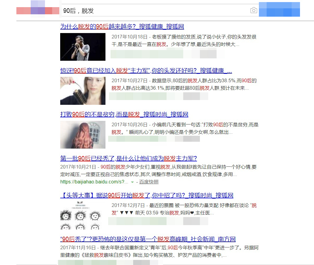 脱发